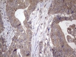 NAB2 Mouse anti-Human, Clone: OTI1E12, lyophilized, TrueMAB 100 &mu;g;