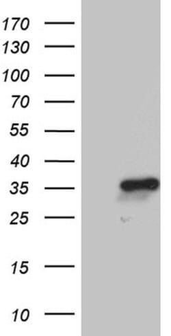 NABP1 Monoclonal Antibody (OTI4D5), TrueMAB , OriGene 100 &mu;L; Unconjugated:Antibodies,