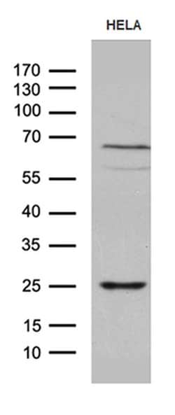 NABP1 Mouse anti-Human, Clone: OTI6B10, TrueMAB , Origene 30 &mu;L; Unconjugated:Antibodies,
