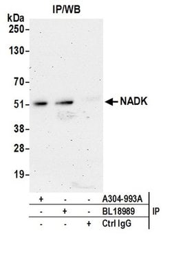 NADK Rabbit anti-Human, Mouse, Polyclonal, Bethyl Laboratories 10 &mu;L;