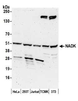 NADK Rabbit anti-Human, Mouse, Polyclonal, Bethyl Laboratories 10 &mu;L;