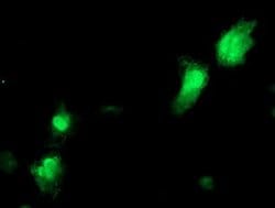 NANP Monoclonal Antibody (OTI2C2), TrueMAB , OriGene 100 &mu;L; Unconjugated:Antibodies,