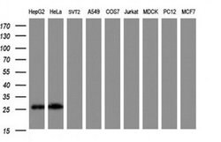 NANP Monoclonal Antibody (OTI2A2), TrueMAB , OriGene 100 &mu;L; Unconjugated:Antibodies,