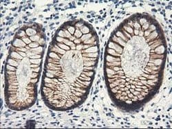 NAPEPLD Mouse anti-Human, Clone: OTI7B9, lyophilized, TrueMAB 100 &mu;g;