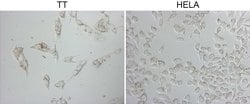 NAPSA Monoclonal Antibody (OTI3E5), TrueMAB , OriGene 100 &mu;L; Unconjugated:Antibodies,