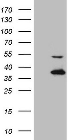 NAPSA Monoclonal Antibody (OTI1B5), TrueMAB , OriGene 100 &mu;L; Unconjugated:Antibodies,