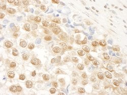 NARG1 Polyclonal Antibody, Bethyl Laboratories:Antibodies:Primary Antibodies
