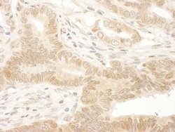 NARG1 Polyclonal Antibody, Bethyl Laboratories 100 &mu;L; Unconjugated:Antibodies,