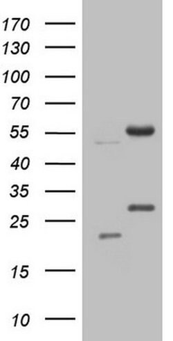 NARS2 Monoclonal Antibody (OTI10C10), TrueMAB , OriGene:Antibodies:Primary
