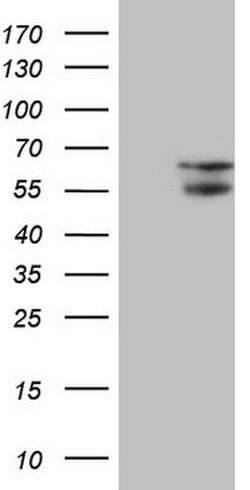 NARS2 Mouse anti-Human, Clone: OTI10E2, lyophilized, TrueMAB 100 &mu;g;