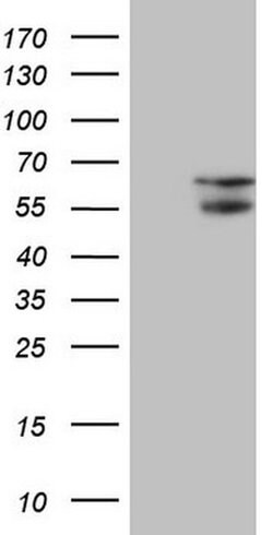 NARS2 Monoclonal Antibody (OTI10E2), TrueMAB , OriGene:Antibodies:Primary
