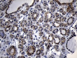 NAT1 Mouse anti-Human, Clone: OTI1G1, lyophilized, TrueMAB 100 &mu;g; Unconjugated:Antibodies,