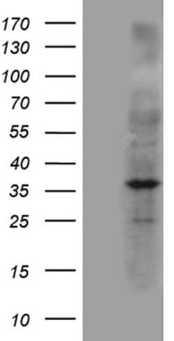 NAT1 Mouse anti-Human, Clone: OTI7G6, lyophilized, TrueMAB 100 &mu;g; Unconjugated:Antibodies,