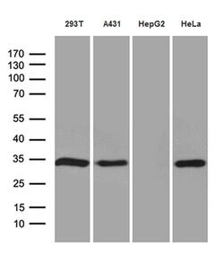 NAT1 Mouse anti-Human, Clone: OTI6D7, liquid, TrueMAB 100 &mu;L | Buy Online | OriGene | Fisher Scientific