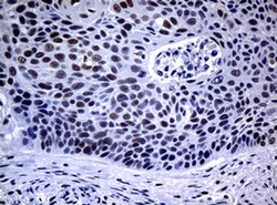 NBN Monoclonal Antibody (OTI1G10), TrueMAB , OriGene 100 &mu;L; Unconjugated:Antibodies,