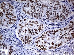 NBN Monoclonal Antibody (OTI1G10), TrueMAB , OriGene 100 &mu;L; Unconjugated:Antibodies,