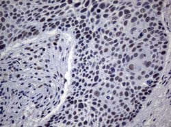 NBN Monoclonal Antibody (OTI8E6), TrueMAB , OriGene 100 &mu;L; Unconjugated:Antibodies,