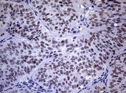 NBN Monoclonal Antibody (OTI8E6), TrueMAB , OriGene:Antibodies:Primary