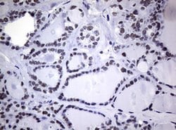 NBN Monoclonal Antibody (OTI8E6), TrueMAB , OriGene:Antibodies:Primary