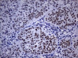 NBN Monoclonal Antibody (OTI6D10), TrueMAB , OriGene 100 &mu;L; Unconjugated:Antibodies,