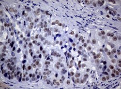NBN Monoclonal Antibody (OTI6D10), TrueMAB , OriGene 100 &mu;L; Unconjugated:Antibodies,