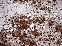 NBN Mouse anti-Human, Clone: OTI8E7, lyophilized, TrueMAB 100 &mu;g; Unconjugated:Antibodies,