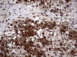 NBN Monoclonal Antibody (OTI8E7), TrueMAB , OriGene 100 &mu;L; Unconjugated:Antibodies,