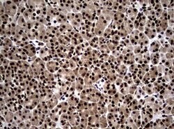 NBN Monoclonal Antibody (OTI8E7), TrueMAB , OriGene 100 &mu;L; Unconjugated:Antibodies,