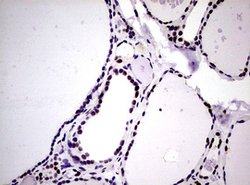 NBN Mouse anti-Human, Clone: OTI8E7, lyophilized, TrueMAB 100 &mu;g; Unconjugated:Antibodies,