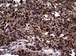 NBN Mouse anti-Human, Clone: OTI8E7, lyophilized, TrueMAB 100 &mu;g; Unconjugated:Antibodies,