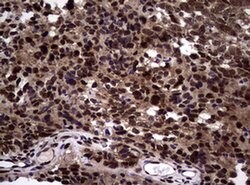NBN Monoclonal Antibody (OTI8E7), TrueMAB , OriGene 100 &mu;L; Unconjugated:Antibodies,