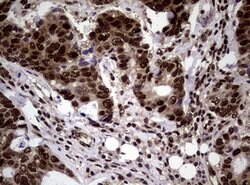 NBN Mouse anti-Human, Clone: OTI8E7, lyophilized, TrueMAB 100 &mu;g; Unconjugated:Antibodies,