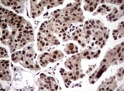 NBN Mouse anti-Human, Clone: OTI8E7, lyophilized, TrueMAB 100 &mu;g; Unconjugated:Antibodies,