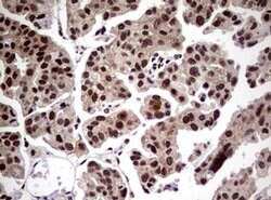 NBN Monoclonal Antibody (OTI8E7), TrueMAB , OriGene 100 &mu;L; Unconjugated:Antibodies,