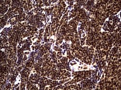 NBN Mouse anti-Human, Clone: OTI8E7, lyophilized, TrueMAB 100 &mu;g; Unconjugated:Antibodies,