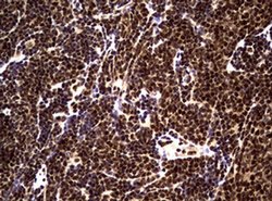 NBN Monoclonal Antibody (OTI8E7), TrueMAB , OriGene 100 &mu;L; Unconjugated:Antibodies,