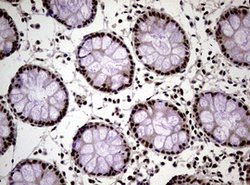 NBN Mouse anti-Human, Clone: OTI8E7, lyophilized, TrueMAB 100 &mu;g; Unconjugated:Antibodies,