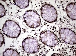 NBN Monoclonal Antibody (OTI8E7), TrueMAB , OriGene 100 &mu;L; Unconjugated:Antibodies,