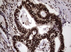 NBN Mouse anti-Human, Clone: OTI8E7, lyophilized, TrueMAB 100 &mu;g; Unconjugated:Antibodies,