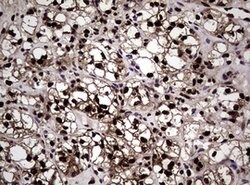 NBN Mouse anti-Human, Clone: OTI8E7, lyophilized, TrueMAB 100 &mu;g; Unconjugated:Antibodies,