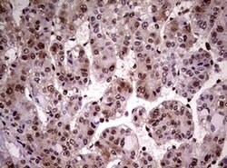 NBN Monoclonal Antibody (OTI8E7), TrueMAB , OriGene 100 &mu;L; Unconjugated:Antibodies,