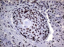 NBN Monoclonal Antibody (OTI9H2), TrueMAB , OriGene 100 &mu;L; Unconjugated:Antibodies,