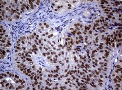 NBN Monoclonal Antibody (OTI9H2), TrueMAB , OriGene 100 &mu;L; Unconjugated:Antibodies,