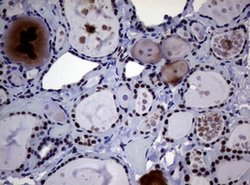 NBN Monoclonal Antibody (OTI9H2), TrueMAB , OriGene 100 &mu;L; Unconjugated:Antibodies,