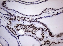 NBN Monoclonal Antibody (OTI9H2), TrueMAB , OriGene 100 &mu;L; Unconjugated:Antibodies,