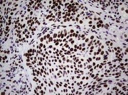 NBN Monoclonal Antibody (OTI6H7), TrueMAB , OriGene 100 &mu;L; Unconjugated:Antibodies,