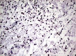 NBN Monoclonal Antibody (OTI6H7), TrueMAB , OriGene 100 &mu;L; Unconjugated:Antibodies,