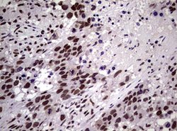 NBN Monoclonal Antibody (OTI6H7), TrueMAB , OriGene 100 &mu;L; Unconjugated:Antibodies,