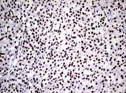 NBN Monoclonal Antibody (OTI6H7), TrueMAB , OriGene 100 &mu;L; Unconjugated:Antibodies,