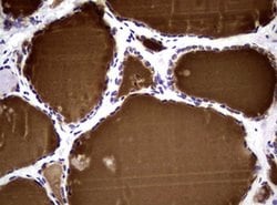 NBN Monoclonal Antibody (OTI6H7), TrueMAB , OriGene 100 &mu;L; Unconjugated:Antibodies,